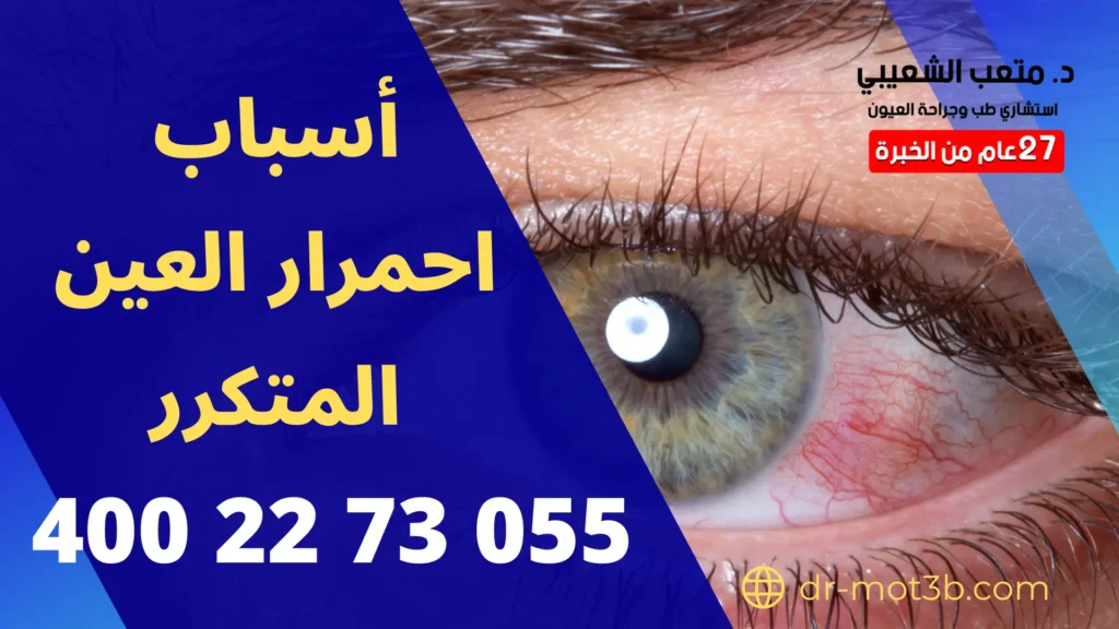 أسباب احمرار العين المتكرر