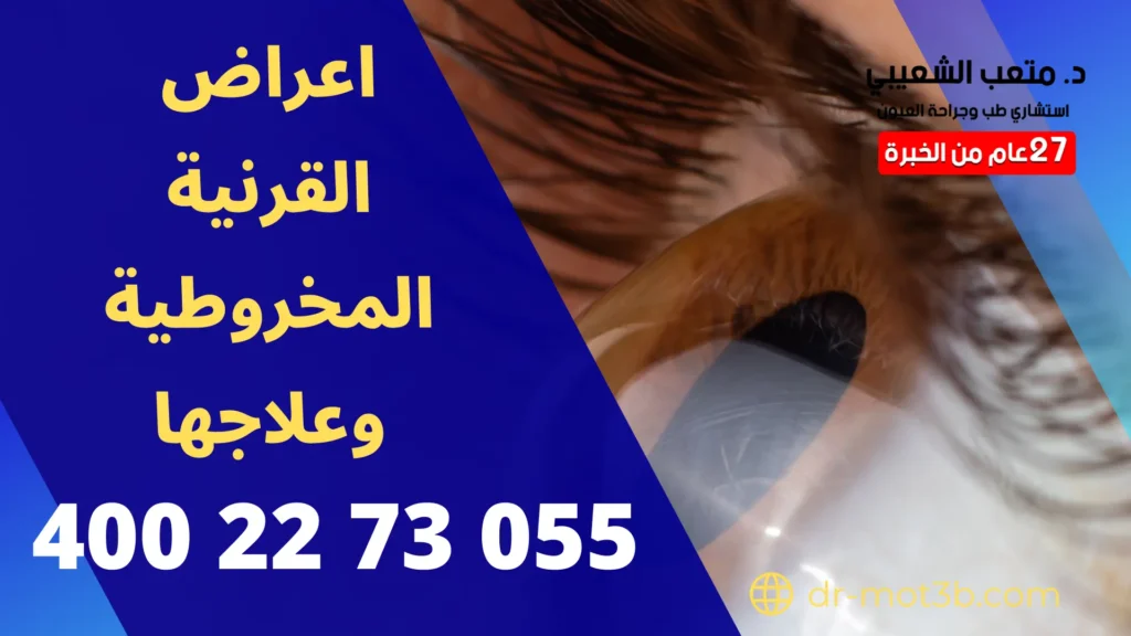 اعراض القرنية المخروطية وعلاجها