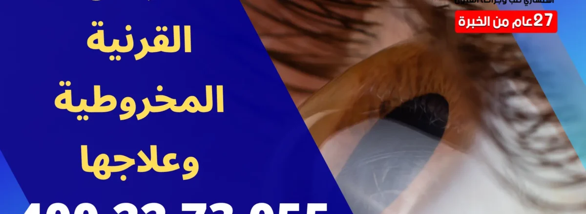 اعراض القرنية المخروطية وعلاجها