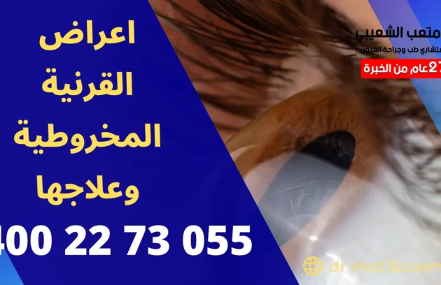 اعراض القرنية المخروطية وعلاجها