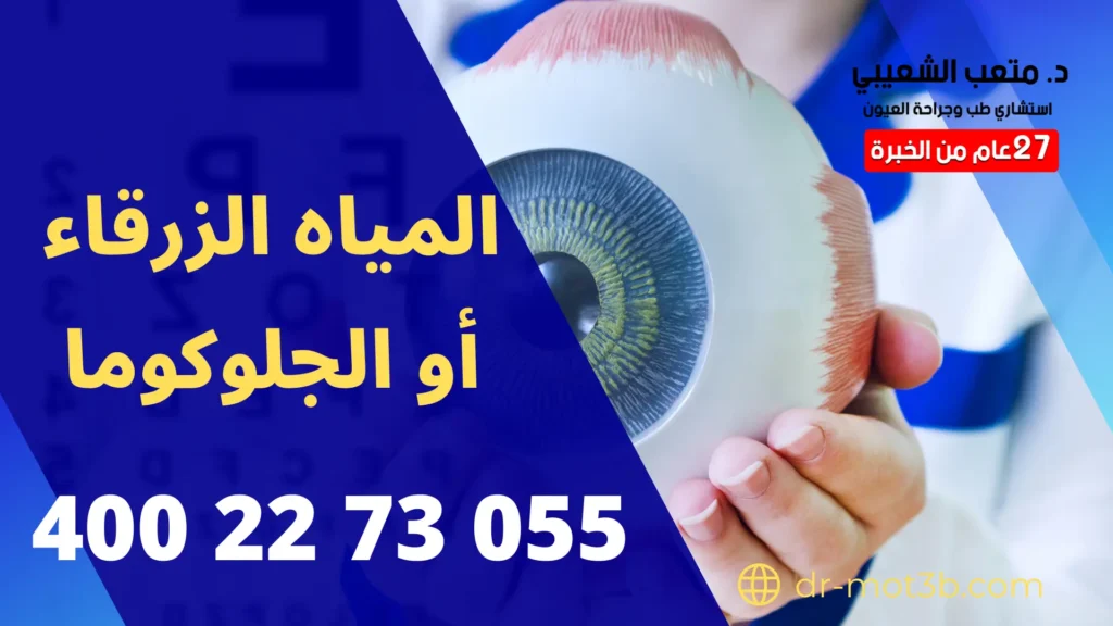 المياه الزرقاء أو الجلوكوما