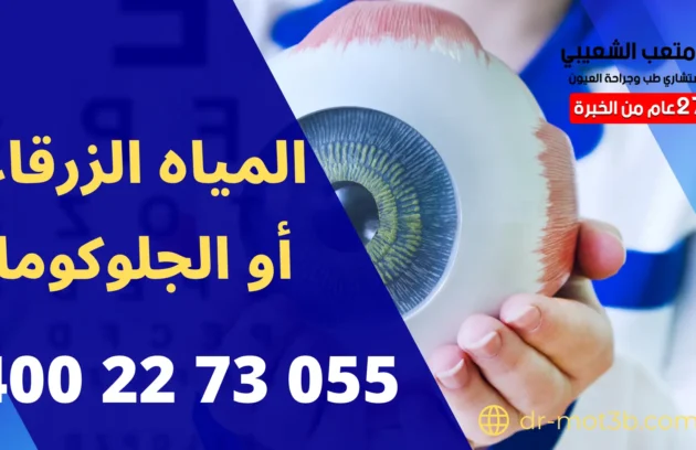 المياه الزرقاء أو الجلوكوما