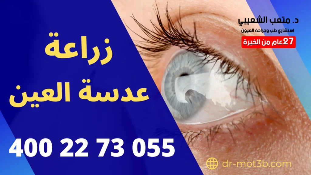 عملية زراعة عدسة العين