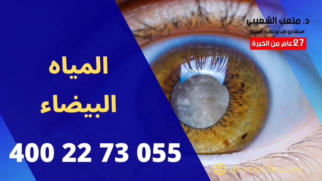 ماهو علاج المياه البيضاء كتاركت
